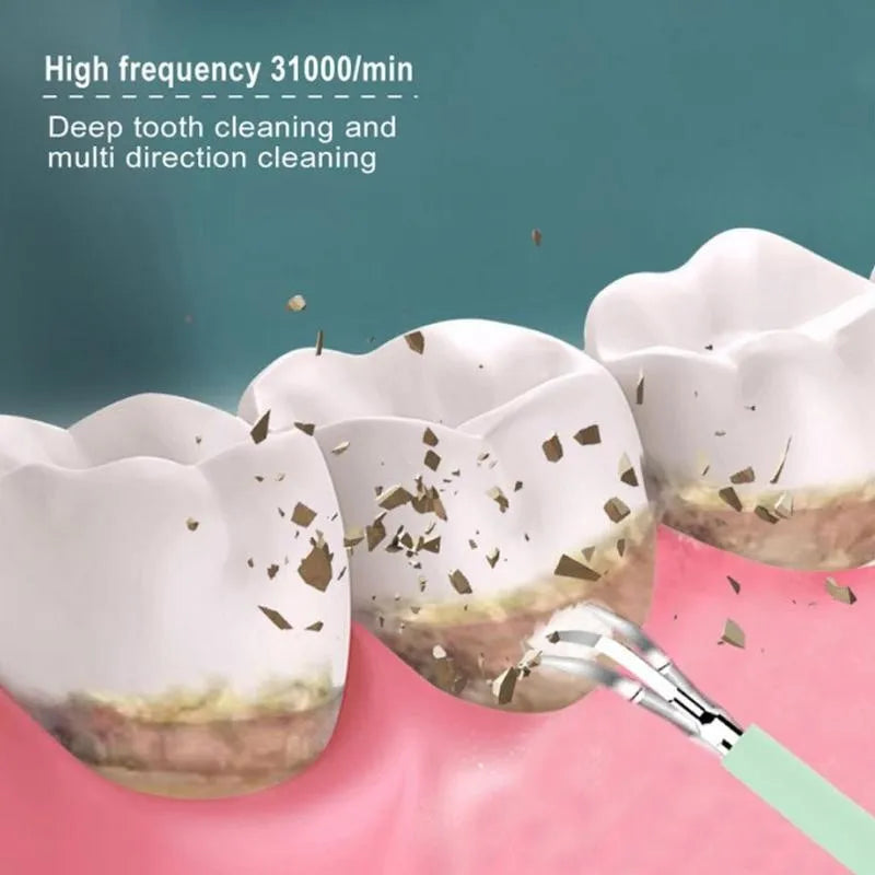 Electric Ultrasonic USB Rechargeable Portable Dental  Cleaner