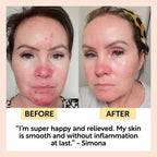 UpCircle - Night Cream with Hyaluronic Acid + Niacinamide - Travel Size