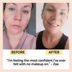 UpCircle - Travel-Size Skincare Bundle