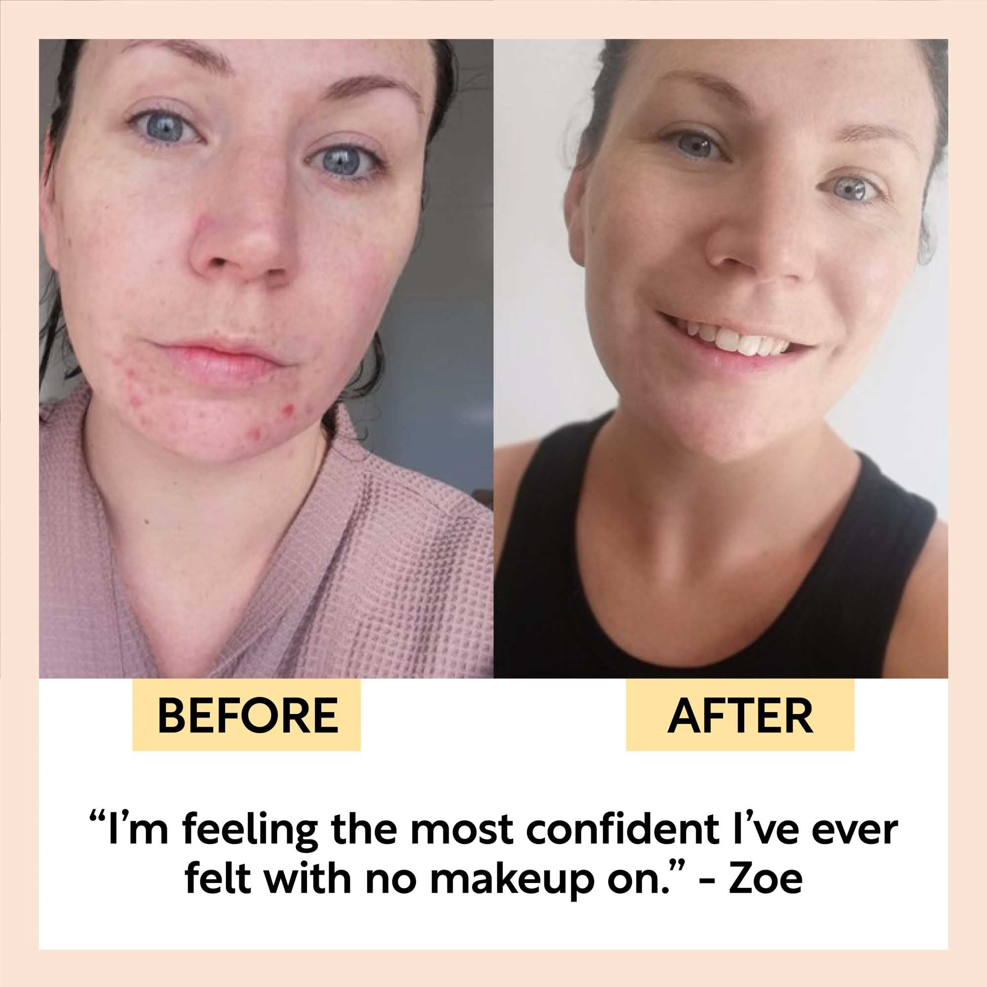 UpCircle - Travel-Size Skincare Bundle